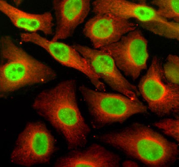Anti-SUPT16H / Suppressor of Ty 16