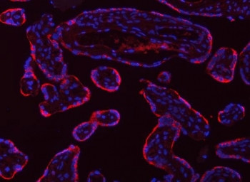 Anti-TPM2 / Tropomyosin 2 / Tropomyosin beta