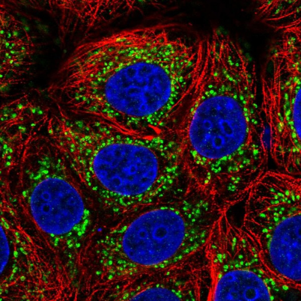Anti-PGAM5