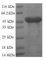 60S ribosomal protein L11 (RPL11), partial, human, recombinant