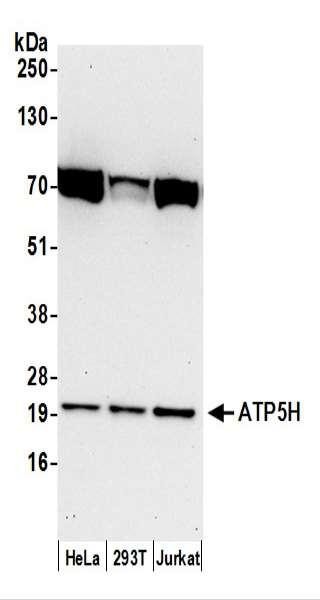 Anti-ATP5H
