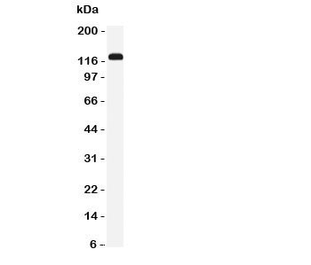 Anti-NKCC2 (SLC12A1)