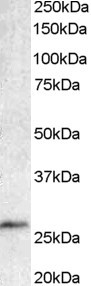 Anti-BCL7A, C-terminal