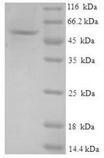 GMP reductase 1 (GMPR), human, recombinant