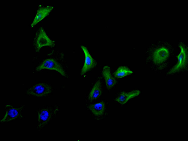 Anti-LY6E, recombinant clone 29C11