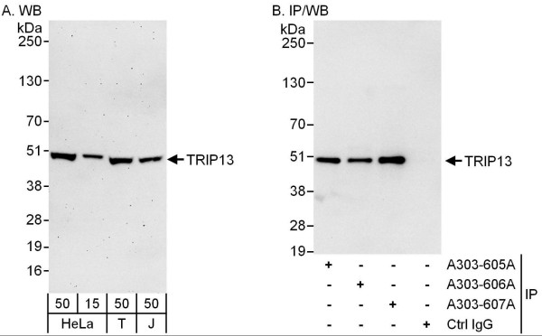 Anti-TRIP13