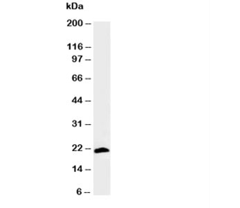 Anti-Myosin (Skeletal Fast), clone MY-38
