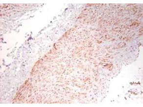 Anti-Tumor Necrosis Factor alpha (TNFa)