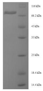 Desmoglein-3 (Dsg3), partial, mouse, recombinant