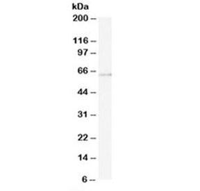 Anti-ARIH1