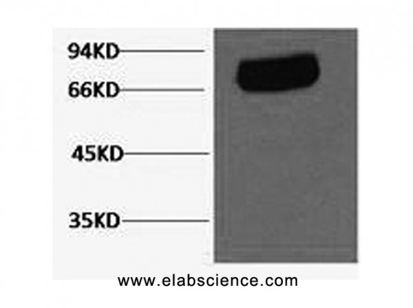 Anti-Transferrin, clone 9B3