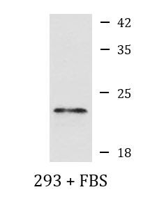 Anti-phospho-4E-BP1 (Thr70)
