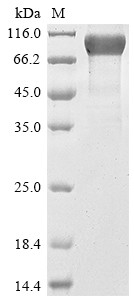 Mucin-16 (MUC16), partial, human, recombinant