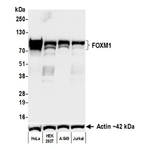 Anti-FOXM1 Recombinant Monoclonal