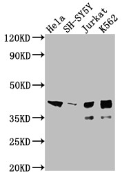 Anti-ISL1 Recombinant Monoclonal, clone 4F6
