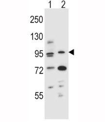 Anti-Aryl Hydrocarbon Receptor Antibody (AHR)