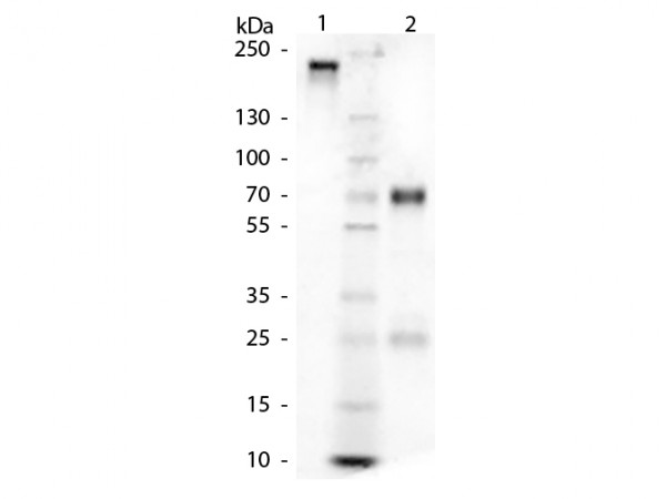 Chicken Gamma Globulin Fraction