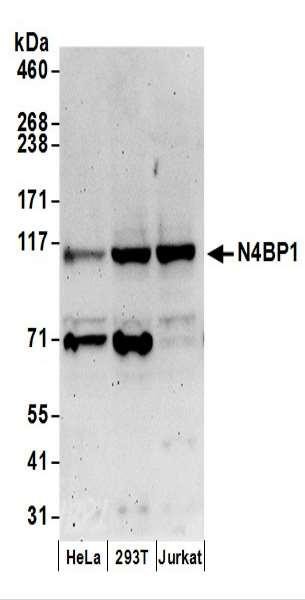 Anti-N4BP1