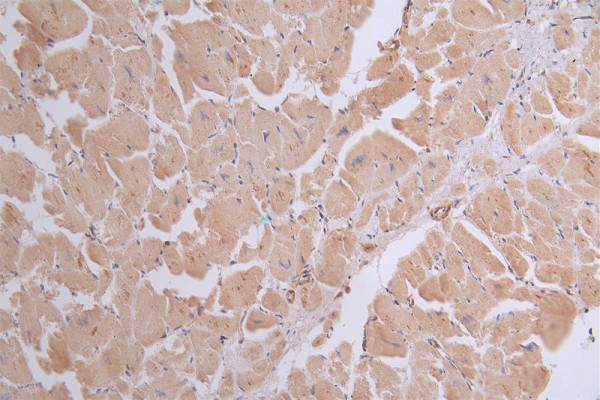 Anti-ATP2A2 Recombinant Monoclonal, clone 20D1
