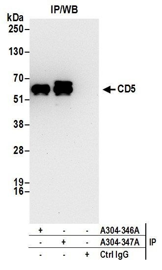 Anti-CD5