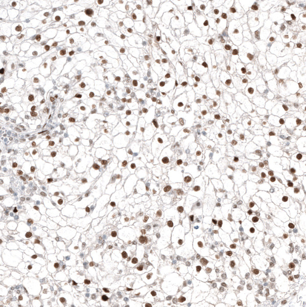 Anti-ABCB5, clone CL12810