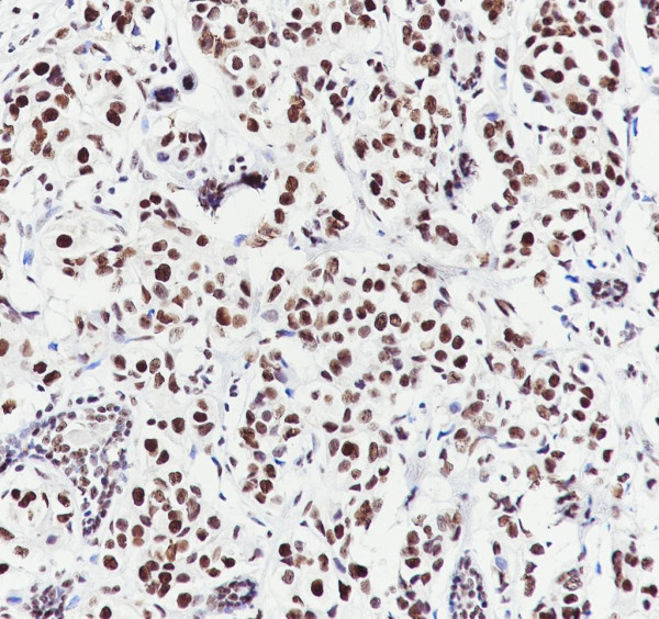 Anti-Recombinant MORF4L2, clone A769