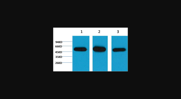 Anti-beta I tubulin, monoclonal