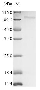 Dihydrolipoyllysine-residue acetyltransferase component of pyruvate dehydrogenase complex, mitochond