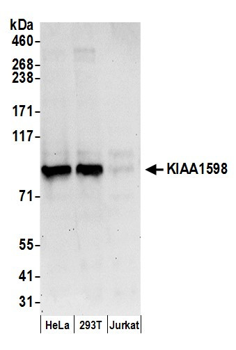 Anti-KIAA1598
