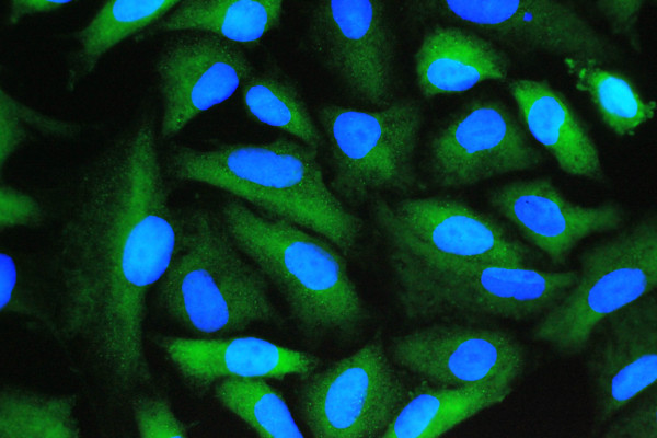 Anti-Cyclophilin A