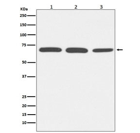 Anti-Albumin / ALB, clone AOHG-1