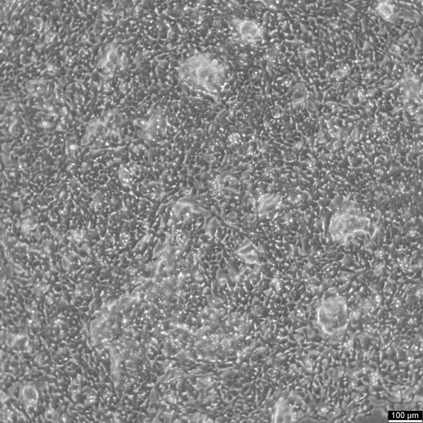 IMR-32 Cells