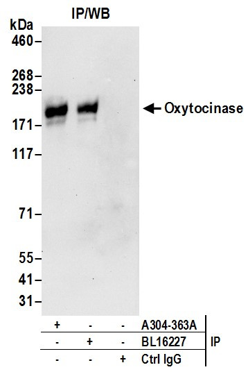 Anti-Oxytocinase