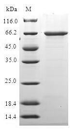 Histone deacetylase 11 (HDAC11), human, recombinant