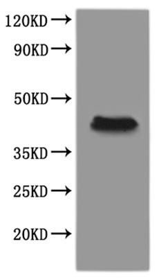 Progestin and adipoQ receptor family member VIII L homeolog (paqr8.L)-VLPs, recombinant Xenopus laev