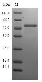 Charged multivesicular body protein 2b (CHMP2B), human, recombinant