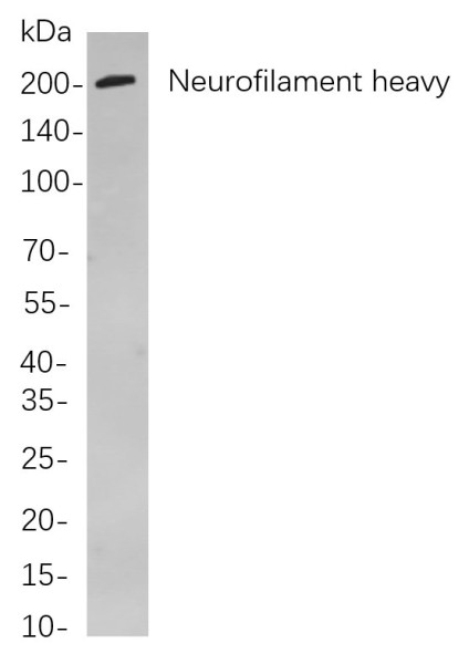 Anti-Recombinant Neurofilament heavy polypeptide, clone 5A6