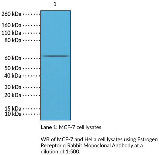 Anti-Estrogen Receptor alpha Rabbit Monoclonal Antibody (Clone RM292)
