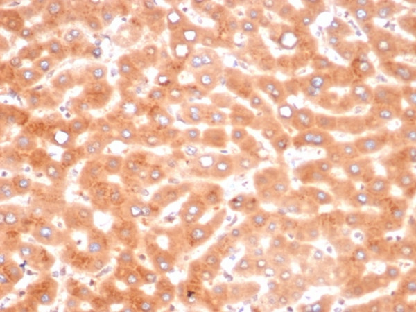 Anti-Alpha-1-Antichymotrypsin (SERPINA3) (Histiocytoma Marker), clone SERPINA3/4187