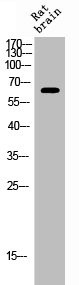 Anti-Phospho-ESR1 (S106)