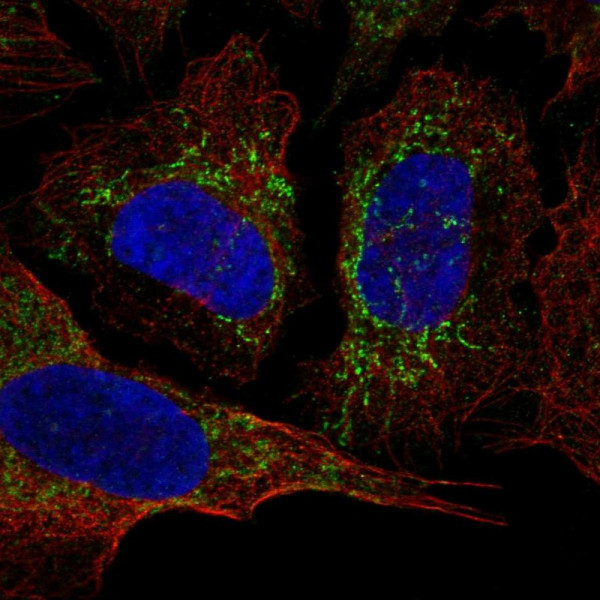 Anti-KCNAB3