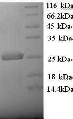 Low-density lipoprotein receptor-related protein 2 (LRP2), partial, human, recombinant