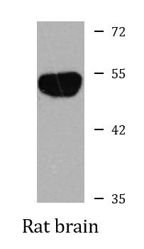Anti-ATP6V1B2