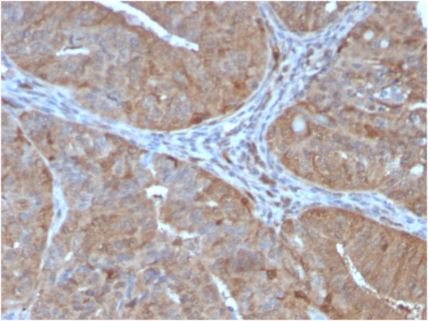 Anti-Aldo-keto Reductase Family 1 Member B1 (Adrenal Marker), clone CPTC-AKR1B1-2