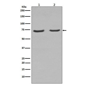 Anti-NGF Receptor / p75NTR / CD271, clone DBO-14