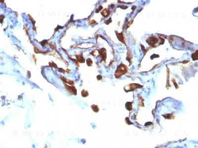 Anti-Cytokeratin 8 (KRT8)(Clone: KRT8/803)