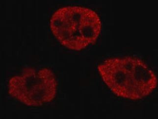 Anti-XRCC1