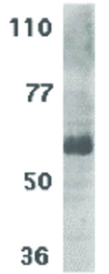 Anti-IL-21 Receptor