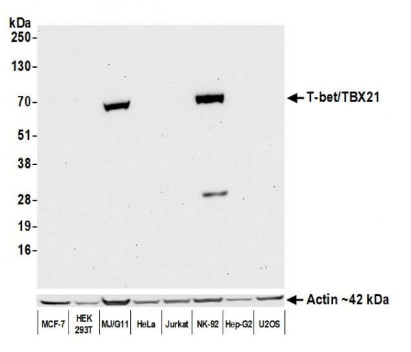 Anti-T-bet/TBX21 Recombinant Monoclonal