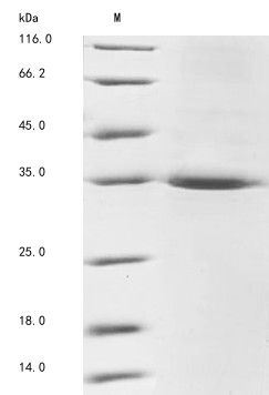 LIM and senescent cell antigen-like-containing domain protein 1 (Lims1), mouse, recombinant